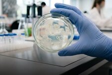 Человеческие сперматозоиды впервые вырастили в лаборатории....jpg